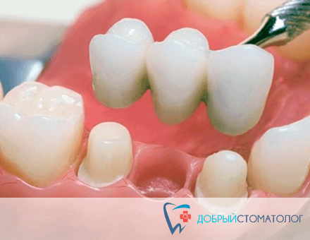 протезирование и лечение зубов в томске